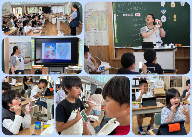 20250626_歯科指導（4年生）